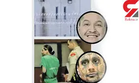 تکه تکه کردن هم سلولی بعد از بریدن سر وی