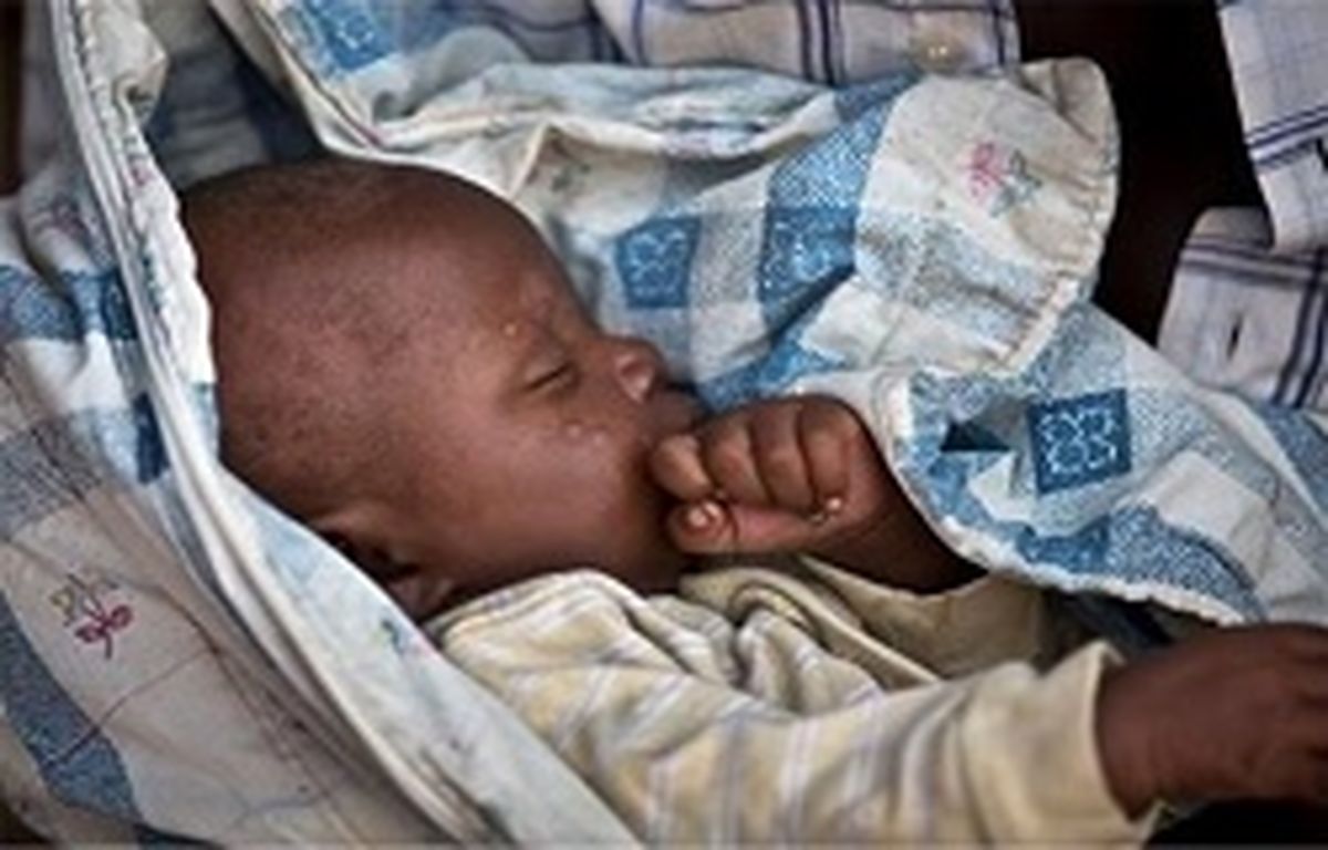 خطر مرگ 1.4 میلیون کودک از گرسنگی در 4 کشور