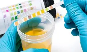 آزمایش ادرار جایگزین «پاپ‌اسمیر» می‌شود