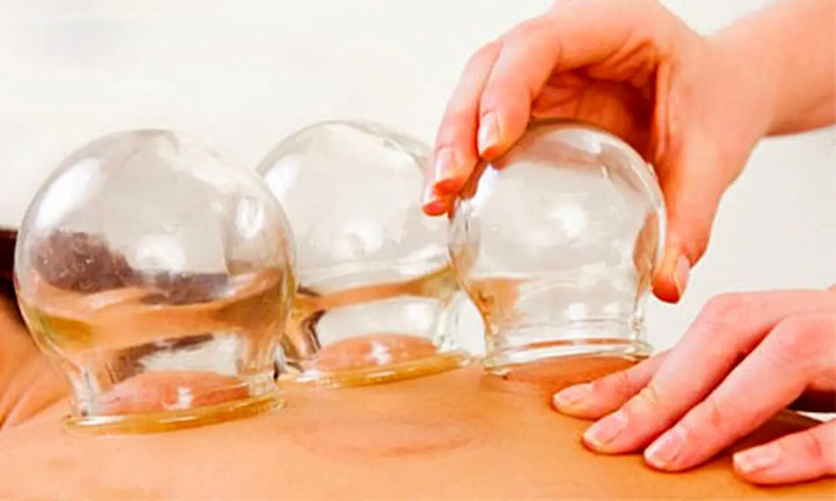 تفاوت حجامت با خون دادن در چیست؟