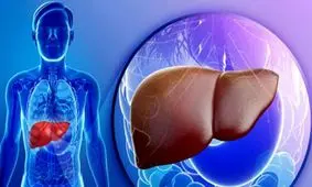 راه های تشخیص و تست کبد چرب در خانه