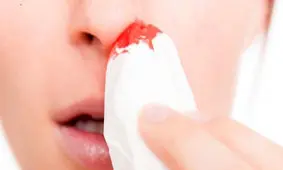 خونریزی بینی در خواب؛ علل و راهکارها