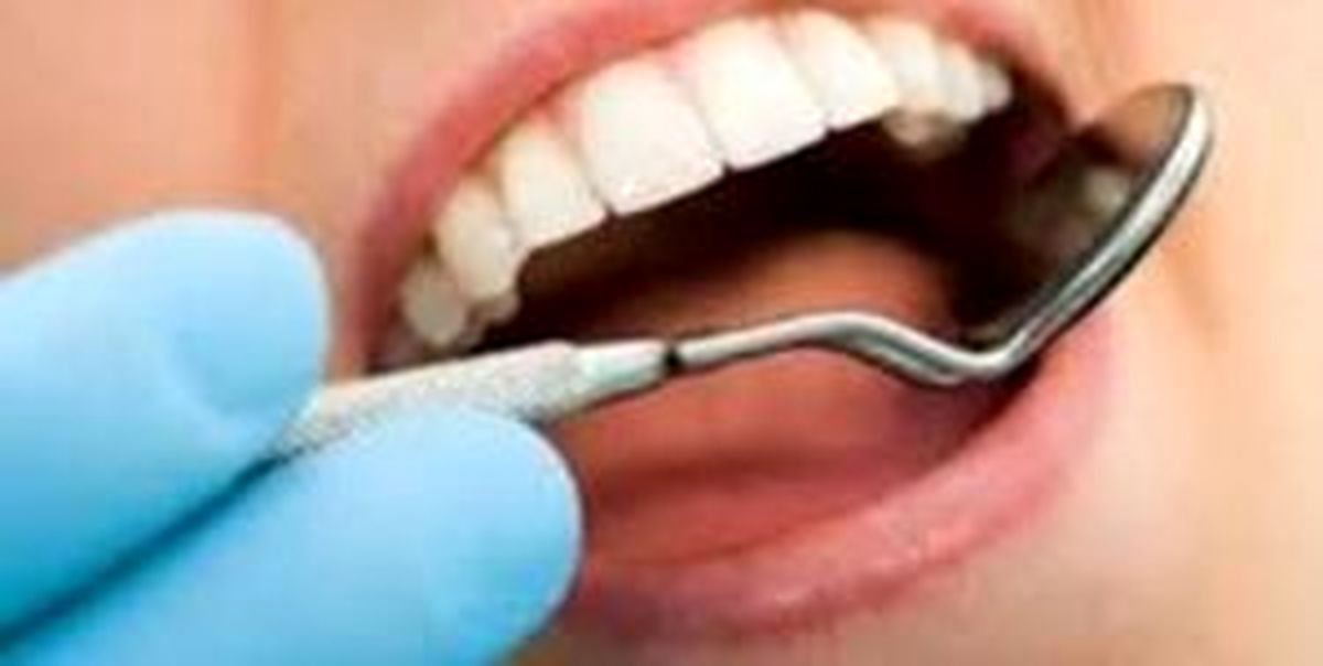 دندان را پر کنیم یا روکش؟