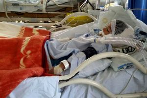 حمله سگ هار به کودک ۵ ساله در بوئین زهرا