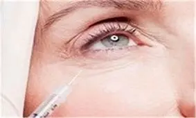 موهای زائد صورت را برای همیشه از بین ببرید