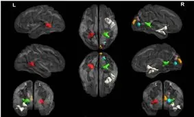 امکان پردازش سریع و شبیه‌سازی‌های پیچیده مغزی با سرور محاسباتی در کشور فراهم شد
