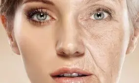 5 راه برای جلوگیری از پیری زودرس پوست