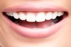 تراشیدن دندان چه بلایی سرتان می آورد؟