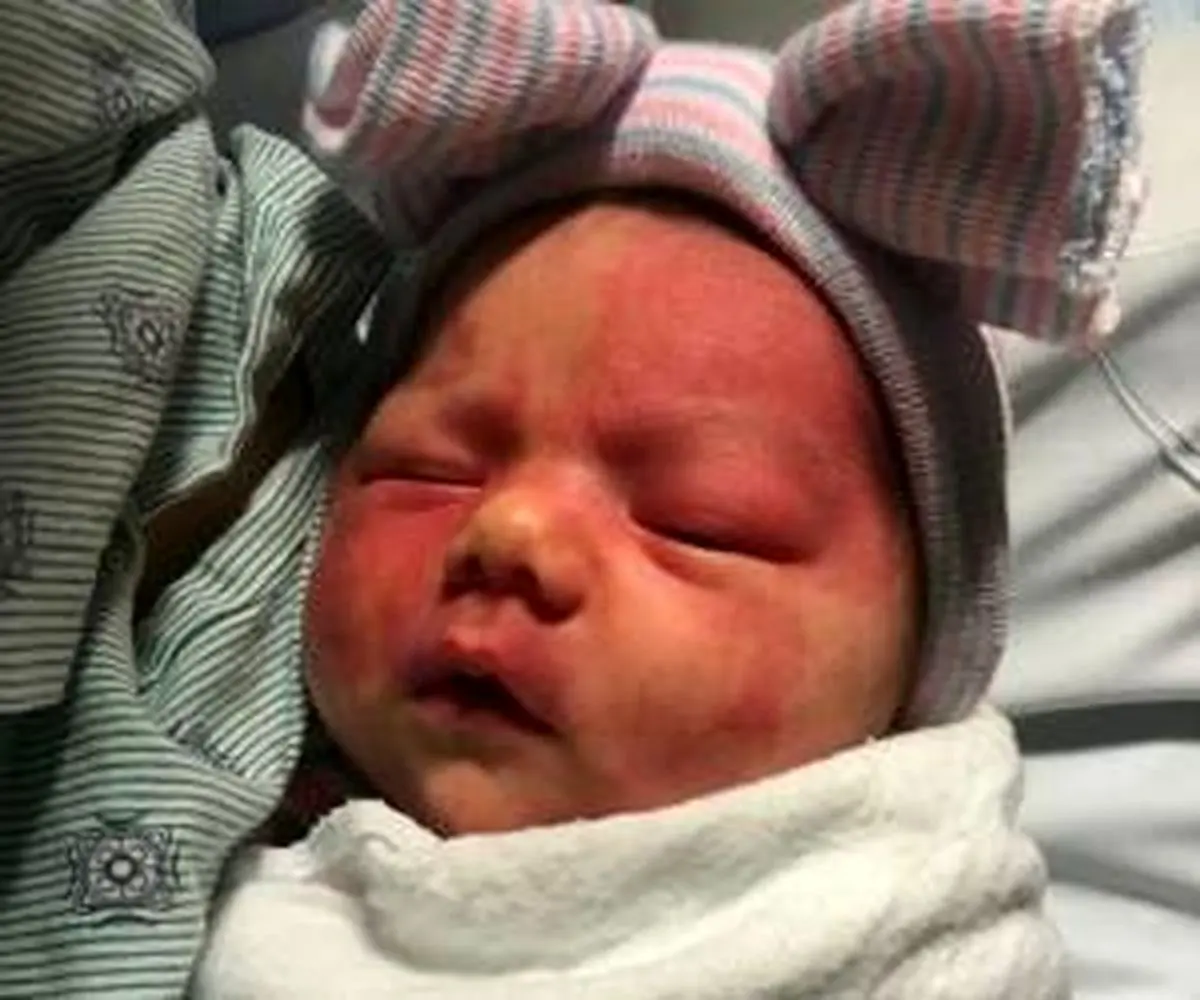 دردسر خال مادرزادی عجیب نوزاد برای مادرش + تصاویر