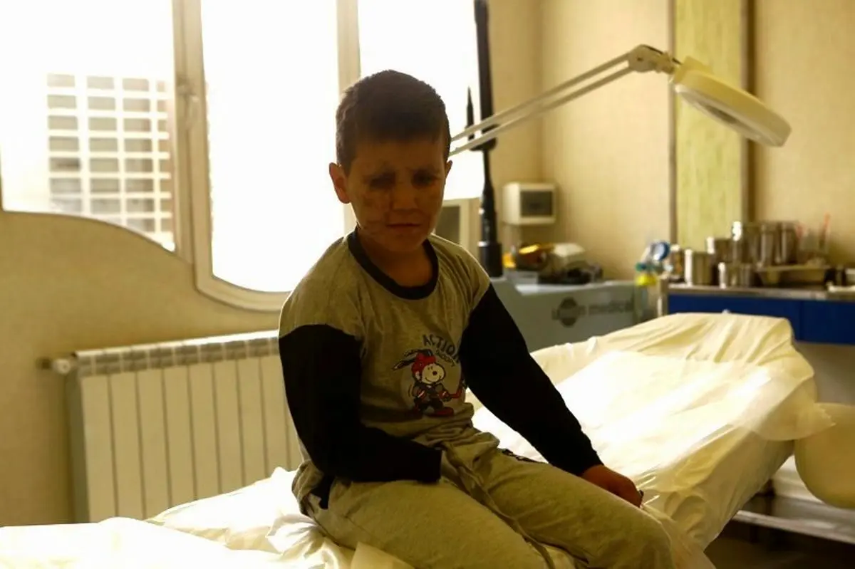 روایت کودکی 9 ساله که قربانی مین شد