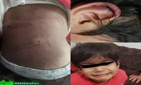 كودک آزارى وحشتناک در اروميه توسط نامادری بى رحم!