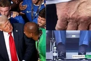 ارزیابی پزشک از وضعیت سلامتی دونالد ترامپ؛ تورم در پاها و کبودی روی دست