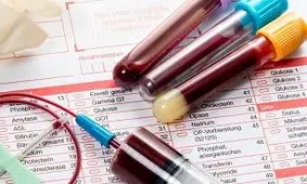 معنی حروف اختصاری در جواب آزمایش‌ها/ اینفوگرافی