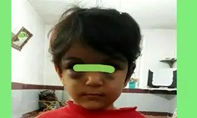 صدور حکم جلب نامادری کودک‌ آزار در ارومیه