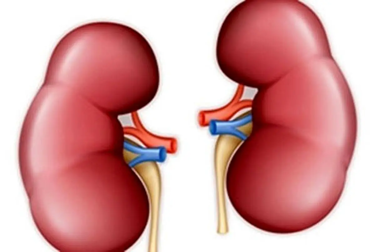 این کودکان شدیدا در معرض ریسک ابتلا به سرطان کلیه هستند