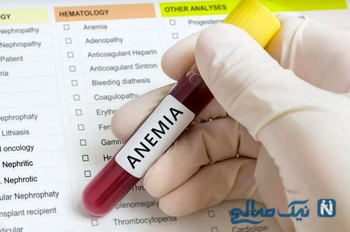 راه‌های رفع کم‌ خونی روزه داران در ماه رمضان