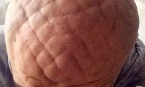 خطوط عجیب روی سر مرد ایتالیایی پزشکان را شگفت زده کرد