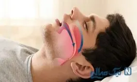 خروپف در مردان به چه میزان شایع است؟