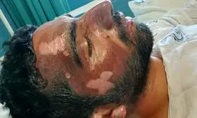 حکایت سوختن مأمور ناجا برای نجات راننده بلوچ