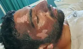 حکایت سوختن مأمور ناجا برای نجات راننده بلوچ