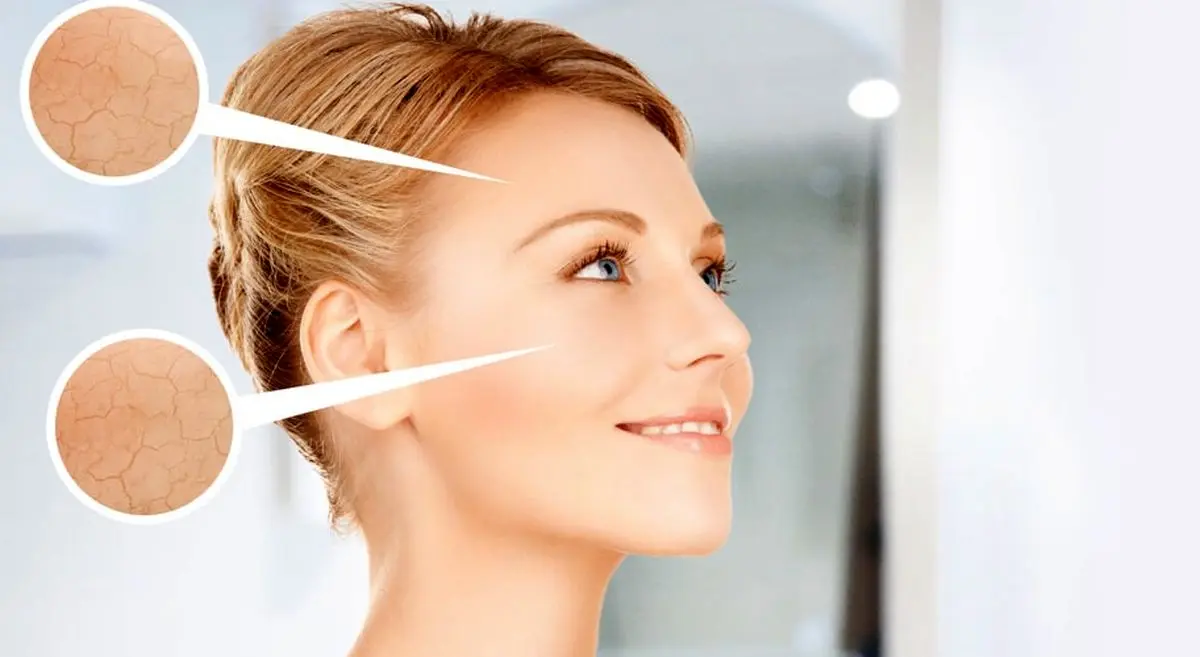 با این خوراکی‌ها پوست‌تان را چند سال جوان‌تر کنید!