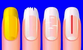 آیا ناخن‌های سالمی دارید؟