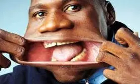  گشاد ترین دهان دنیا در گینس