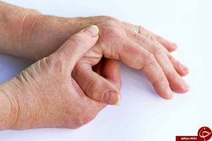 بررسی روش‌های درمانی یک بیماری مفصلی به نام آرتریت پسوریاتیک