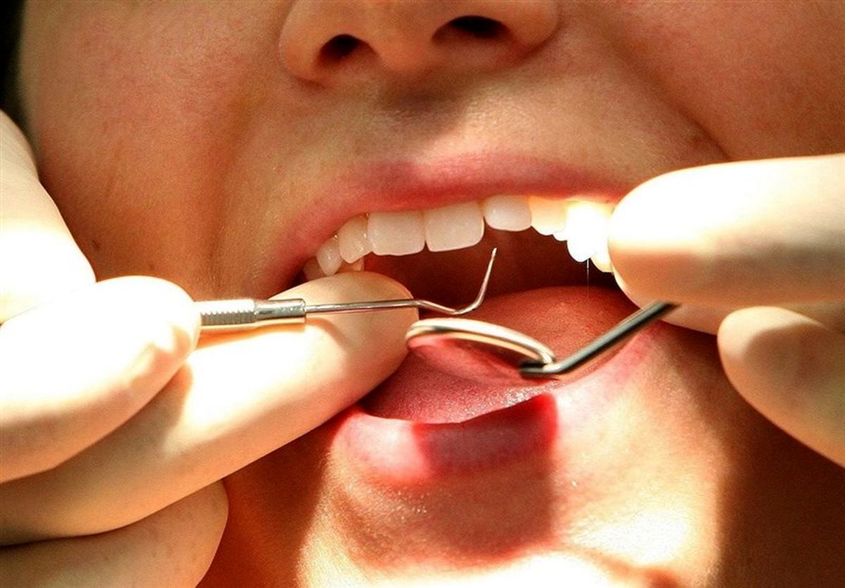 ۴ روش خانگی برای درمان حساسیت دندان