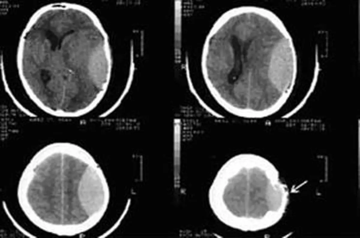 طراحی نرم افزار دستگاه سی تی اسکن ۴ بعدی توسط محققان کشور