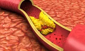 کاهش کلسترول با مصرف سویا