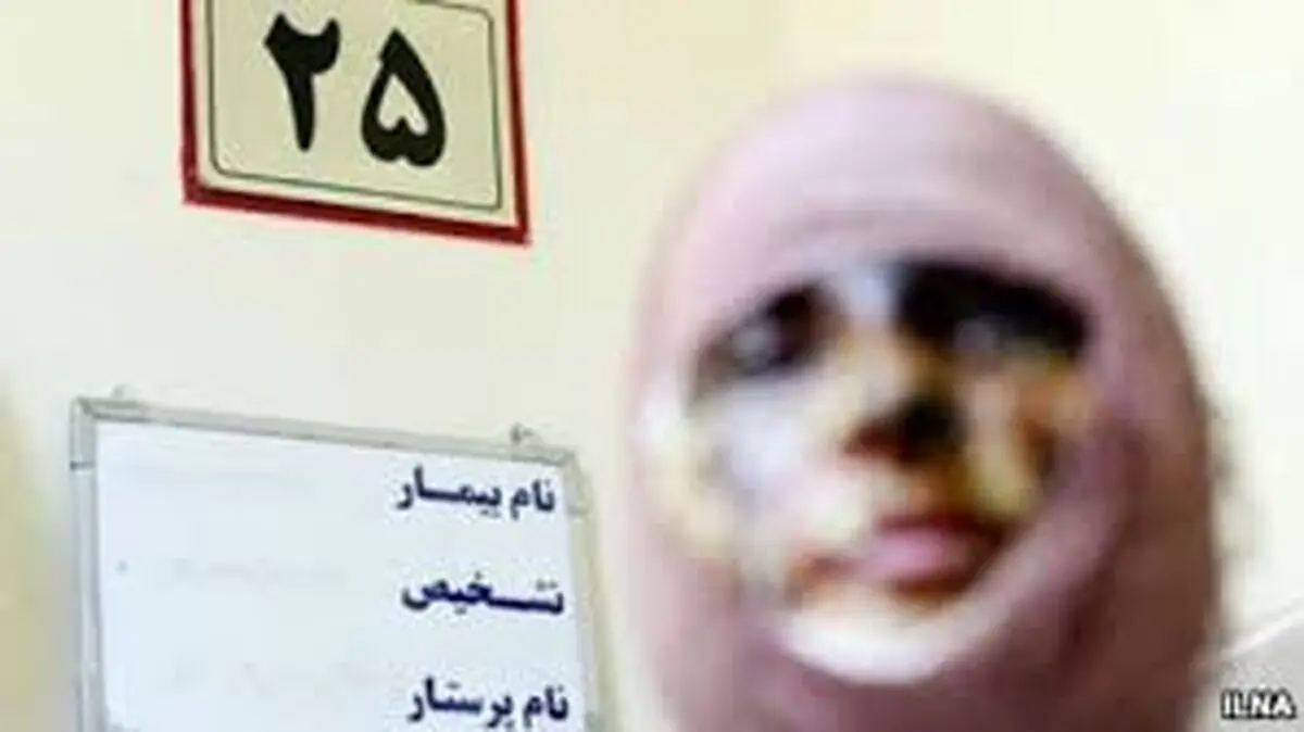 عامل حل مشکلات خانوادگی از طریق اسیدپاشی