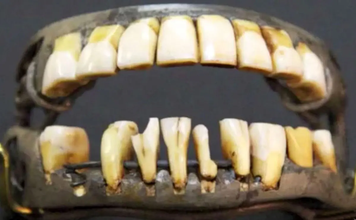 ماجرای دندان جنجالی مشهورترین چهره سیاسی جهان + عکس