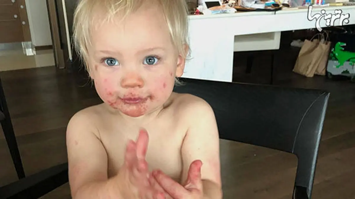 همه چیز درباره شایع‌ترین بیماری نوزادان + راهکار‌هایی برای پیشگیری