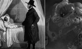 عجیب و غریب‌ترین عقیده پزشکان در گذشته که باورتان نمی‌شود!