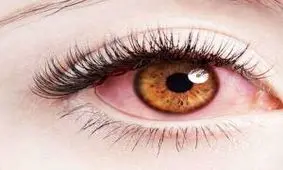 حقایق باورنکردنی در مورد چشم ؛ موجودی با 12 چشم و 3 پلک