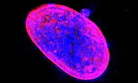 تشخیص ساده‌تر سرطان با بررسی کروموزوم‌ها