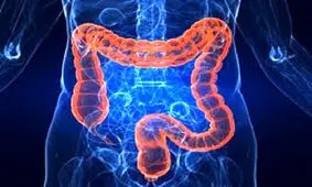 این افزودنی در آدامس و سس مایونز سلامت روده را به خطر می‌اندازد