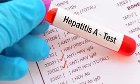 با هپاتیت بیشتر آشنا شوید