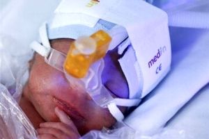 ورود تیم بازرسی وزارت بهداشت به پرونده فوت ۶ نوزاد
