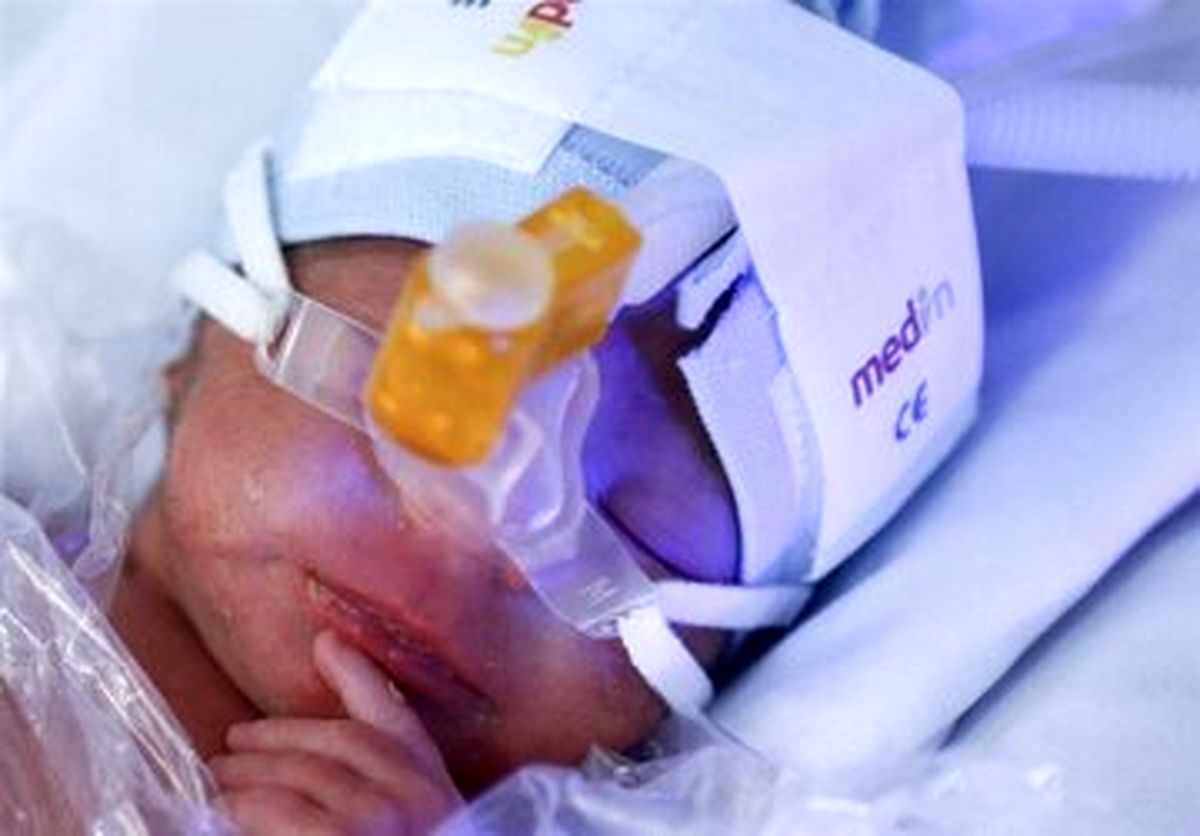 ورود تیم بازرسی وزارت بهداشت به پرونده فوت ۶ نوزاد