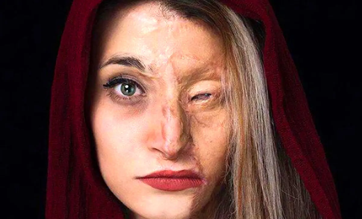 مجلس کاری کند تا اسید مثل آب خوردن در دسترس نباشد