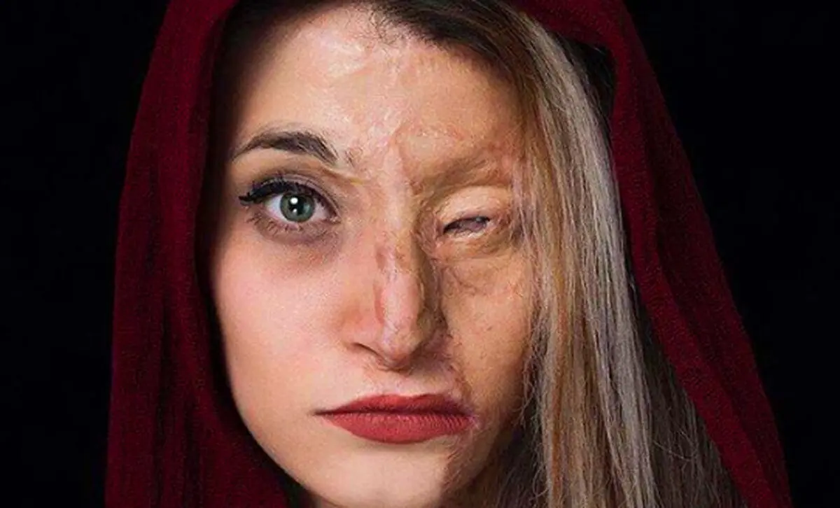 مجلس کاری کند تا اسید مثل آب خوردن در دسترس نباشد