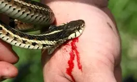 مارگزیدگی، بزرگ‌ترین بحران پنهان سلامت جهانی