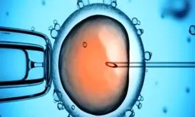 درمان ناباروری مردانه با لقاح داخل رحمی