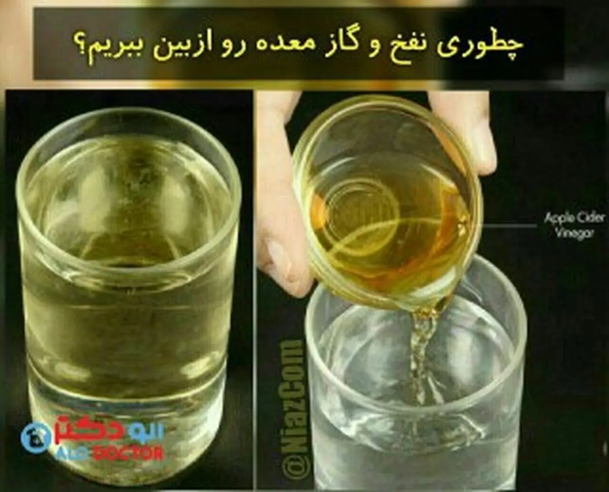 چطور نفخ و گاز معده را از بین ببریم