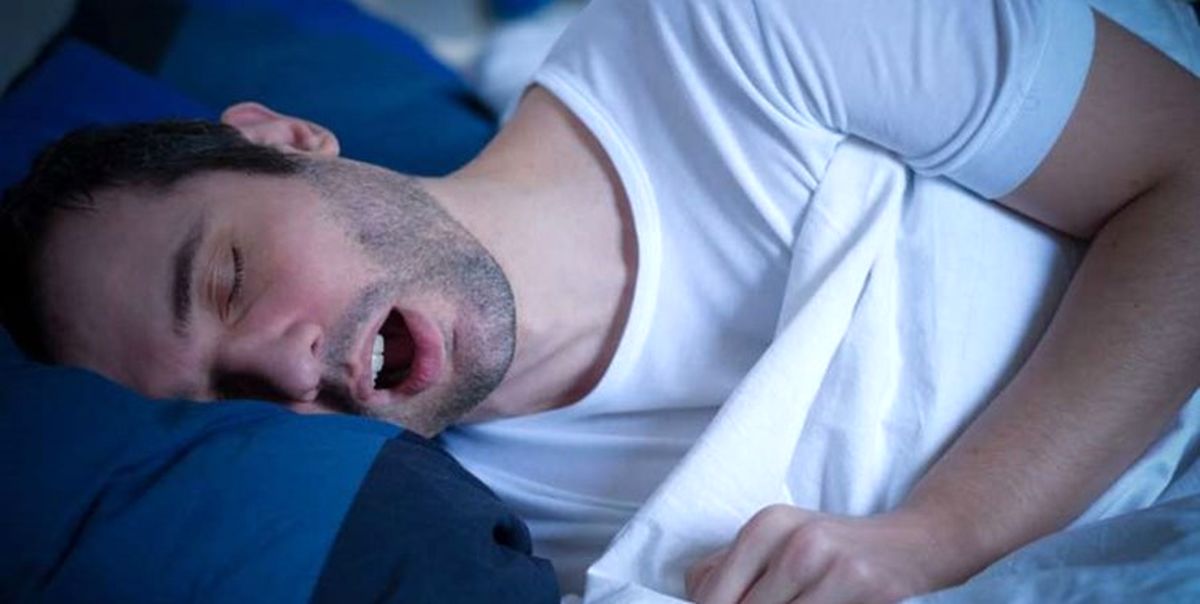 خروپف اعصاب و ماهیچههای کام را از بین میبرد