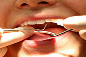 نکات مهم برای سلامت دهان و دندان