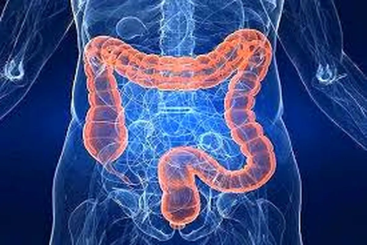 افزایش ابتلا به سرطان روده در میان جوانان