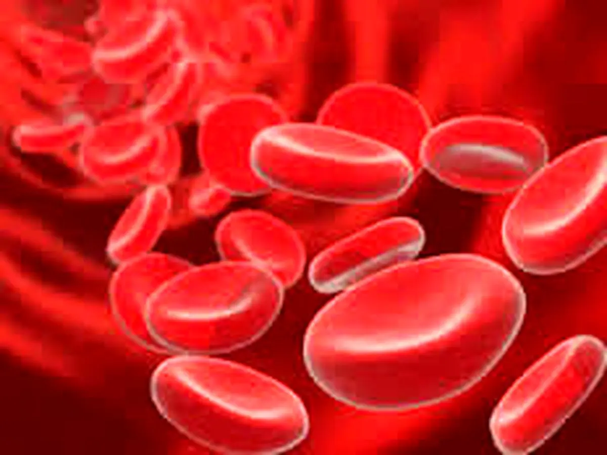 آیا فقر آهن دارید؟